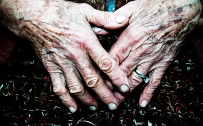 Early Detection of Parkinson’s Disease: The Role of Skin Swabs and Canine Scent