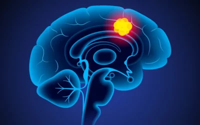 Man’s Deadly Brain Cancer Tumor Disappears After Experimental Drug Trial